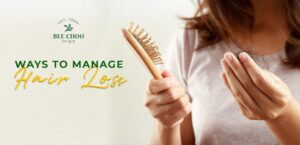Ways to Manage Hair Loss