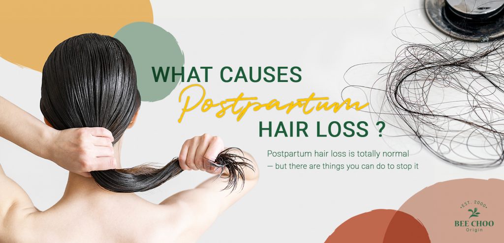 What causes postpartum hair loss? 1 What causes postpartum hair loss