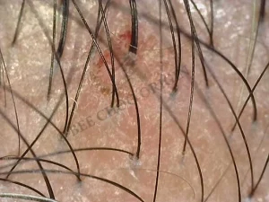 Scalp image