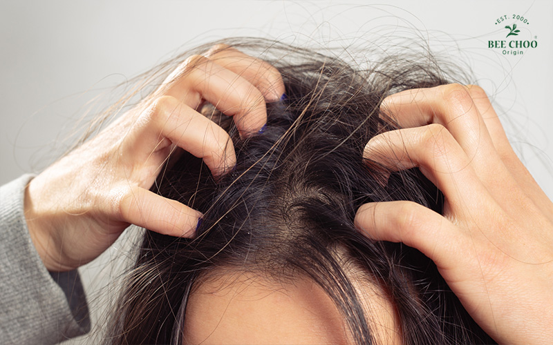 A woman scratching her head from an itchy scalp