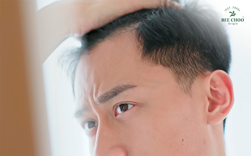 Male Pattern Baldness: How to Tackle Signs of Balding Hair 5 A man identifying signs of hair balding