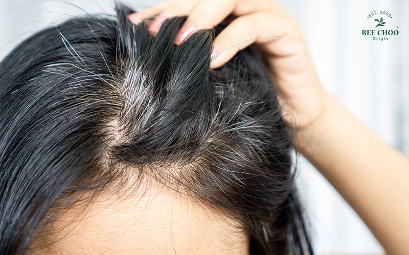 Image of person showing grey hair on their head