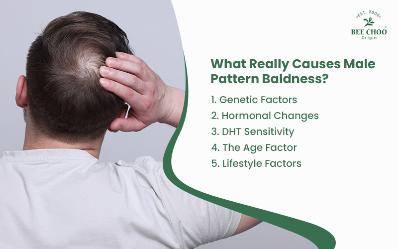 Male Pattern Baldness: How to Tackle Signs of Balding Hair 2 Infographic of what causes male pattern baldness