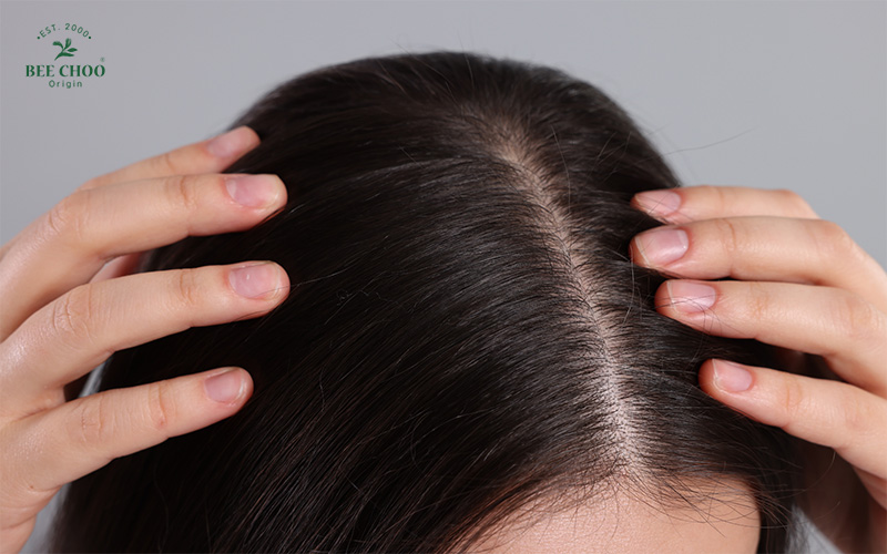 A balanced scalp