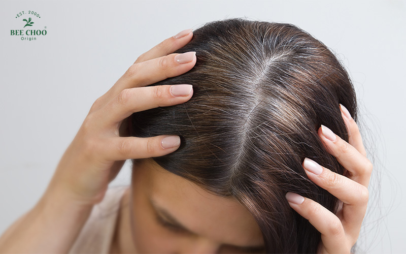 A person showing their grey hair and dark roots.