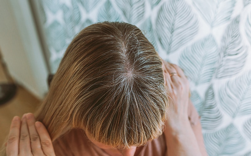 topdown-view-of-a-womans-scalp-showing-fine-hair-parting-and-gray-roots